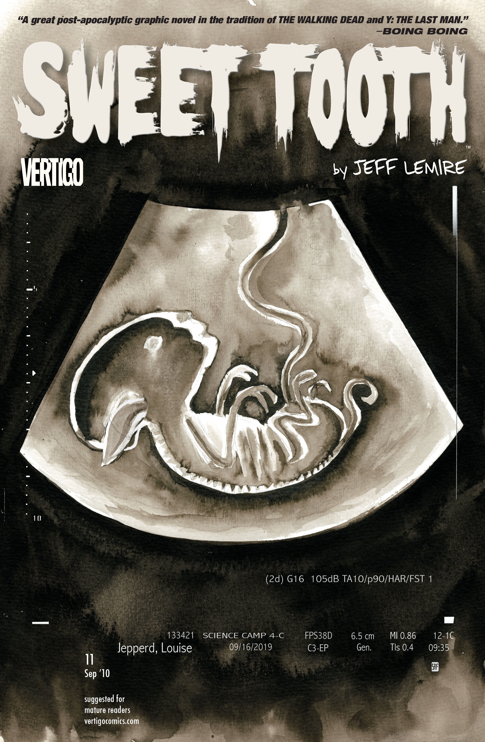 Sweet Tooth Issue #11 - Page 1